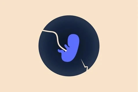 Why Do Miscarriages Occur? Understanding the Science Behind Pregnancy Loss